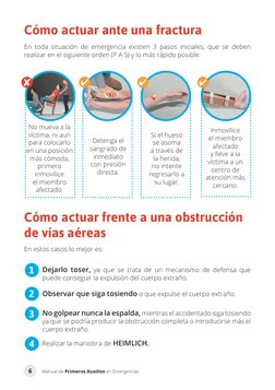 Manual de Primeros Auxilios en Emergencias
6
Cómo actuar ante una fractura
Cómo actuar frente a una obstrucción 
de vías aére