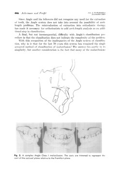 Ackerman-Proffit Malocclusion Classification | PDF | Orthodontics | Mouth