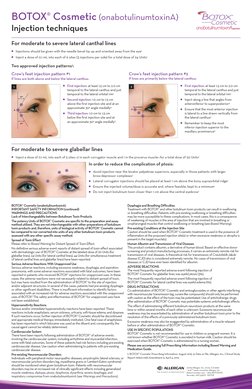 For moderate to severe lateral canthal lines
l	 Injections should be given with the needle bevel tip up and oriented away fro