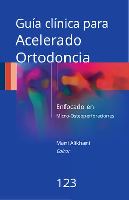 Guía clínica para
Acelerado
Ortodoncia
Enfocado en
Micro-Osteoperforaciones
Mani Alikhani
Editor
123
