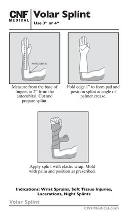 Splint Line Guide Splinting Techniques and Guidelines | PDF | Thumb | Hand