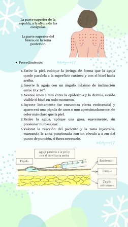 Estire la piel, coloque la jeringa de forma que la aguja
quede paralela a la superficie cutánea y con el bisel hacia
arriba.