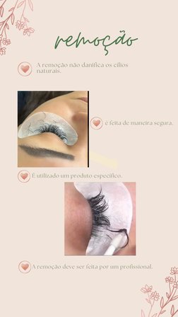 remoção
A remoção não danifica os cílios
naturais.
é feita de maneira segura.
É utilizado um produto específico.
A remoção de