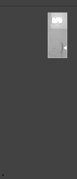 RT Film Interpretation (Image - Guide) | PDF | Nondestructive Testing ...